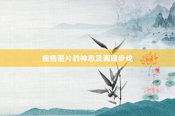 痤疮图片的神志及调理步伐